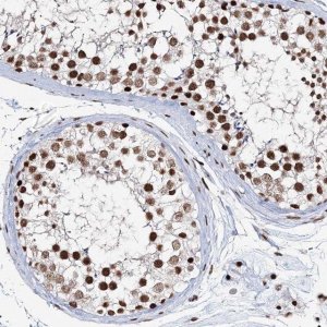Anti-QRICH1 antibody produced in rabbit 