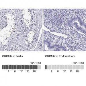 Anti-QRICH2 antibody produced in rabbit 