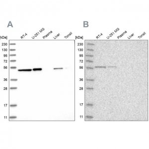 Anti-QRSL1 antibody produced in rabbit HPA029585-100UL