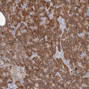 Anti-QRSL1 antibody produced in rabbit HPA029585-100UL