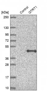 Anti-QTRT1 antibody produced in rabbit 