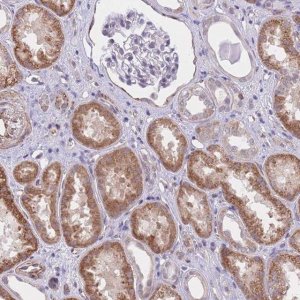 Anti-QTRT1 antibody produced in rabbit 