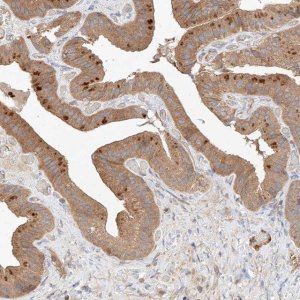 Anti-RAB23 antibody produced in rabbit 