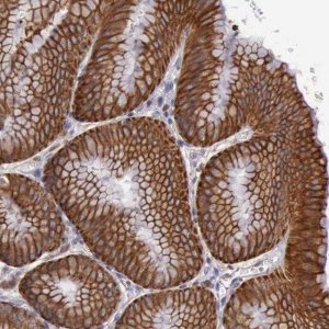 Anti-RAB39B antibody produced in rabbit HPA001114-100UL