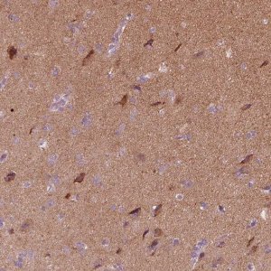 Anti-RAB3C antibody produced in rabbit 