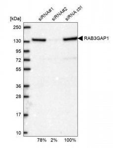 Anti-RAB3GAP1 antibody produced in rabbit 