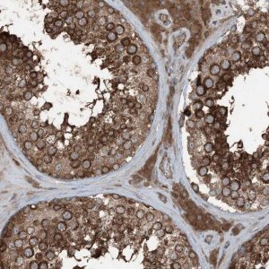 Anti-RAB3GAP1 antibody produced in rabbit 