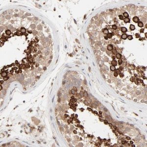 Anti-RAB5C antibody produced in rabbit 