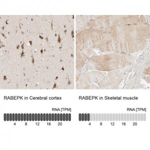 Anti-RABEPK antibody produced in rabbit 