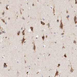Anti-RABEPK antibody produced in rabbit 