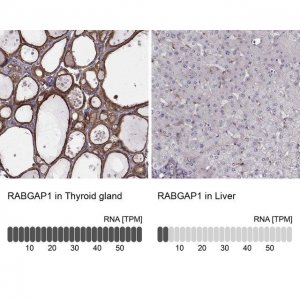Anti-RABGAP1 antibody produced in rabbit 