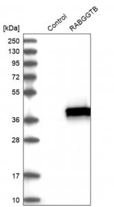 Anti-RABGGTB antibody produced in rabbit 
