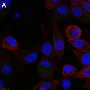 Anti-Rabies glycoprotein Antibody, clone 24-3F-10 ZooMAb Mouse Monoclonal 