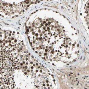 Anti-RAD17 antibody produced in rabbit 