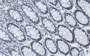 Anti-RAD21 Antibody, clone 2H12 ZooMAb Rabbit Monoclonal 