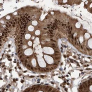Anti-RAD23B antibody produced in rabbit 