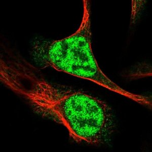 Anti-RAD54L antibody produced in rabbit HPA028954-100UL