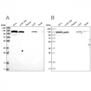 Anti-RAI14 antibody produced in rabbit 