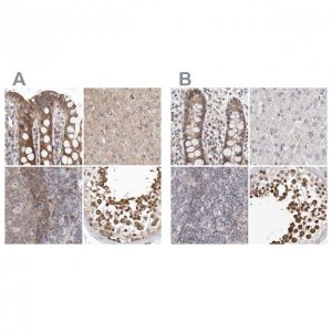 Anti-RALGPS2 antibody produced in rabbit HPA028328-100UL