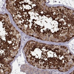 Anti-RANBP1 antibody produced in rabbit 