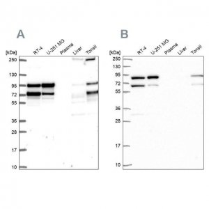 Anti-RANGAP1 antibody produced in rabbit 