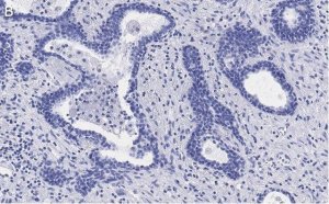 Anti-RAR-alpha Antibody, clone 3L14, ZooMAb Rabbit Monoclonal 