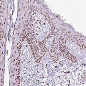 Anti-RARG antibody produced in rabbit 