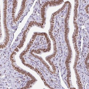 Anti-RARG antibody produced in rabbit 