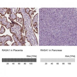 Anti-RASA1 antibody produced in rabbit 
