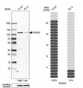 Anti-RASA2 antibody produced in rabbit 