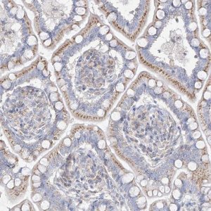 Anti-RASA2 antibody produced in rabbit 