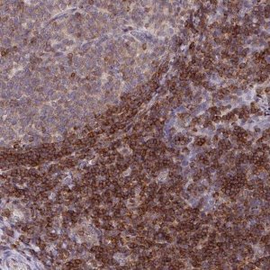 Anti-RASAL3 antibody produced in rabbit 
