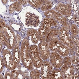 Anti-RASD1 antibody produced in rabbit 