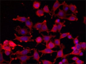 Anti-RASD2 antibody produced in rabbit SAB4200432-200UL