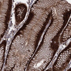 Anti-RASSF3 antibody produced in rabbit 