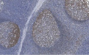 Anti-Rb Antibody, clone 2M15 ZooMAb Rabbit Monoclonal 