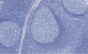 Anti-Rb Antibody, clone 2M15 ZooMAb Rabbit Monoclonal 