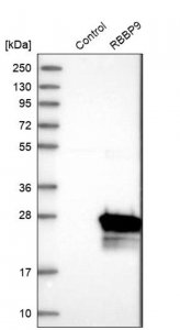Anti-RBBP9 antibody produced in rabbit HPA015830-100UL