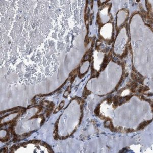 Anti-RBBP9 antibody produced in rabbit HPA015830-100UL