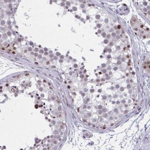 Anti-RBL1 antibody produced in rabbit 