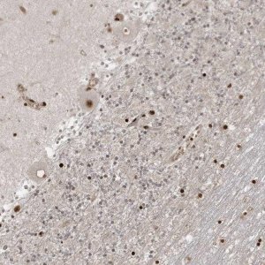 Anti-RBM10 antibody produced in rabbit 