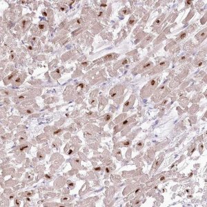 Anti-RBM20 antibody produced in rabbit 