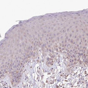Anti-RBM20 antibody produced in rabbit 