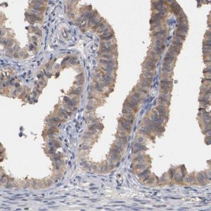 Anti-RBM23 antibody produced in rabbit 