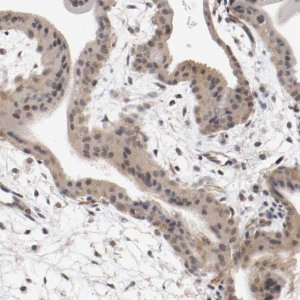 Anti-RBM23 antibody produced in rabbit 