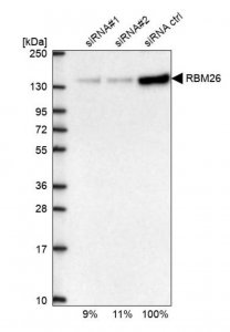 Anti-RBM26 antibody produced in rabbit 