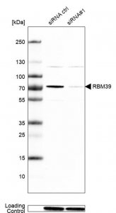 Anti-RBM39 antibody produced in rabbit HPA001591-100UL