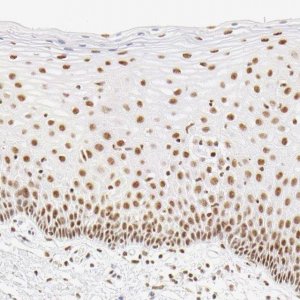 Anti-RBM39 antibody produced in rabbit HPA001591-100UL