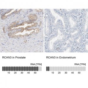 Anti-RCAN3 antibody produced in rabbit 