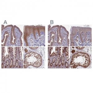 Anti-RCCD1 antibody produced in rabbit 